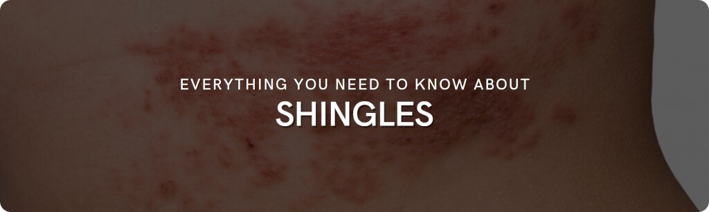 everything about shingles
