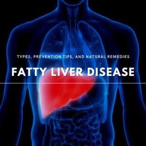 fatty liver disease types prevention and remedy tips