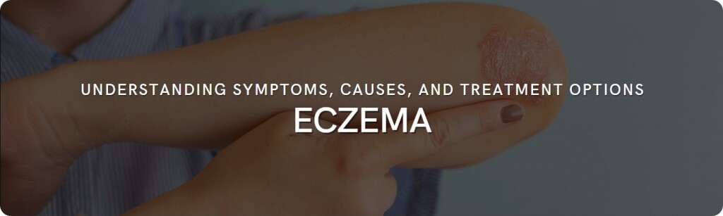 about eczema