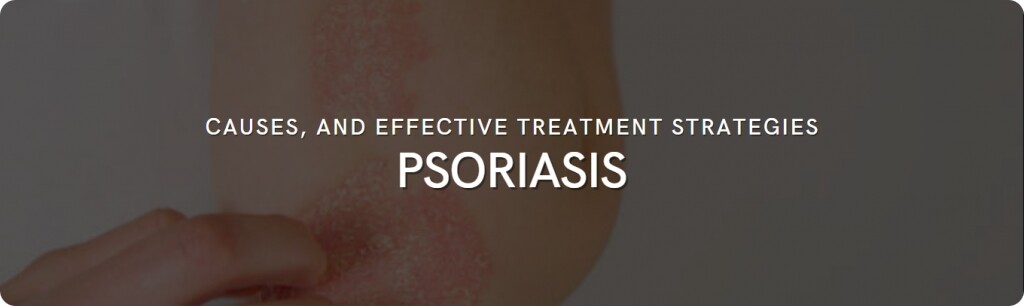 about psoriasis