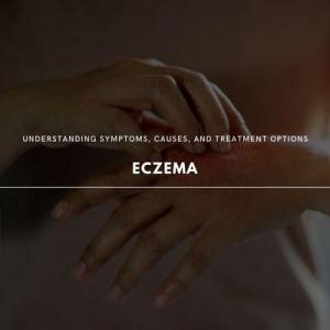 eczema 101