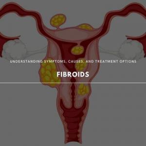 fibroids 101
