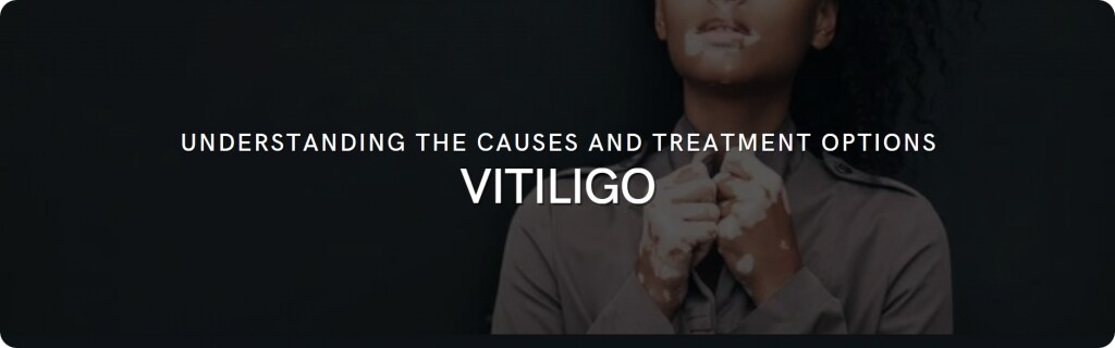 about vitiligo