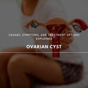 ovarian cyst 101