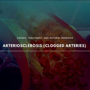 arteriosclerosis 101