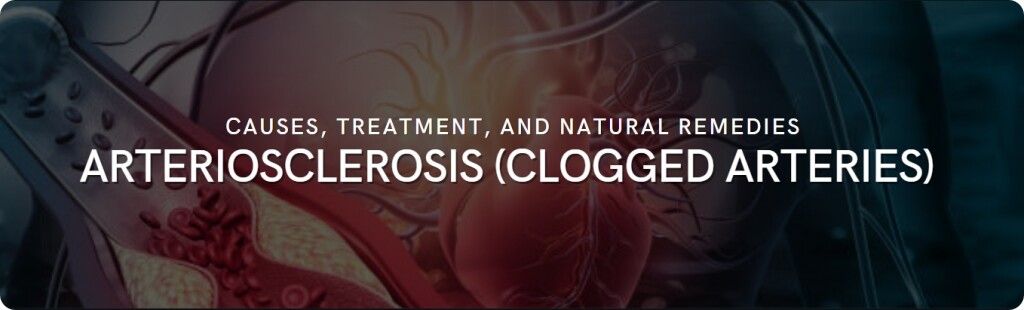 arteriosclerosis facts tips