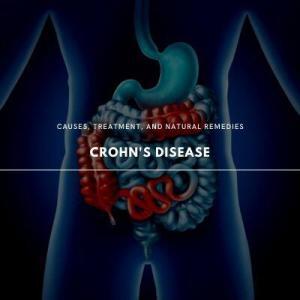 crohn's disease 101