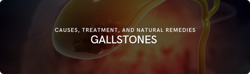 gallstones fact sheet